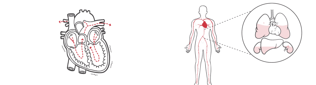 example of medical whiteboard animation
