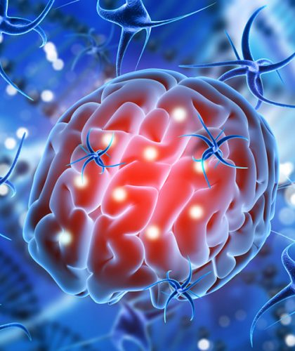 3D medical animation project