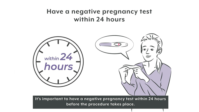 Making a Sensitive Fertility Procedure Easier for Patients to Understand 3 Visual Explanation of the Procedure