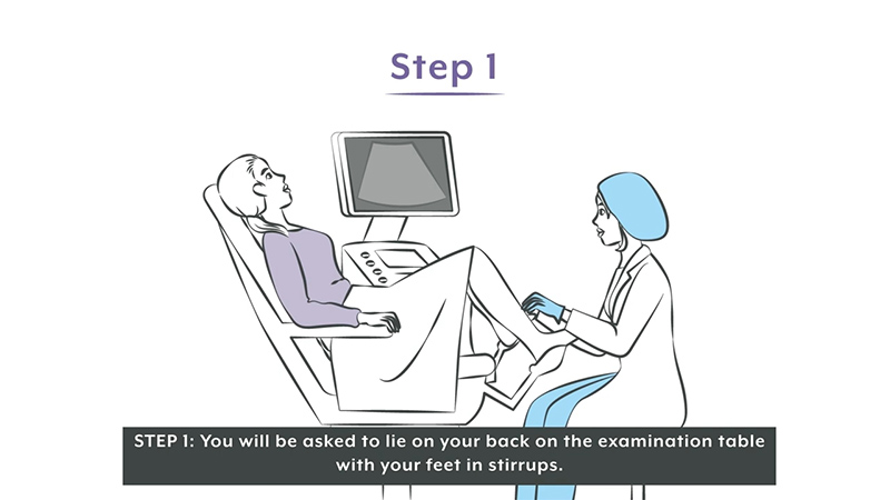 Making a Sensitive Fertility Procedure Easier for Patients to Understand 2 ExEm Women’s Health - Patient Education