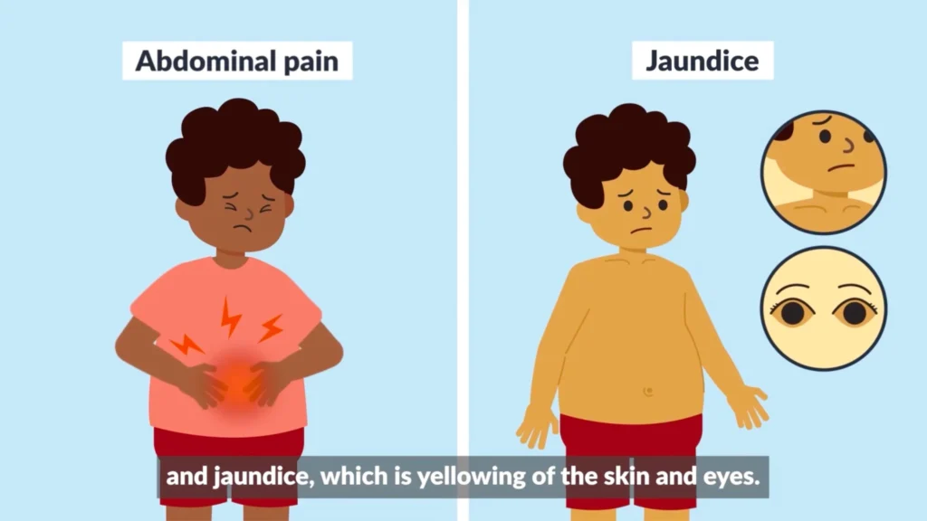 Stanford Medicine Childrens Health Discharge-Day Education Is Too Late.