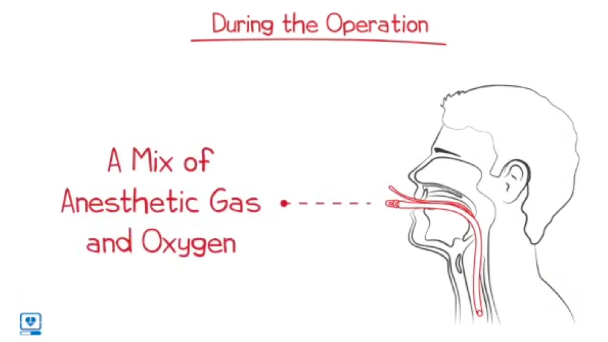 General Anesthesia Medical and healthcare professional education